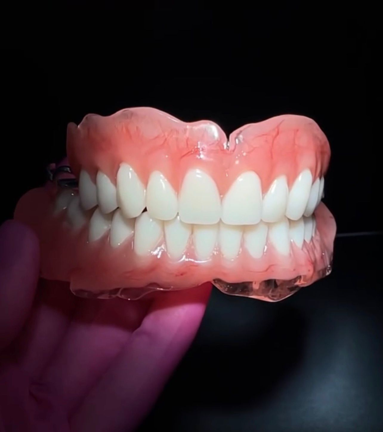 Prótese dentária total superior e inferior confeccionada em laboratório